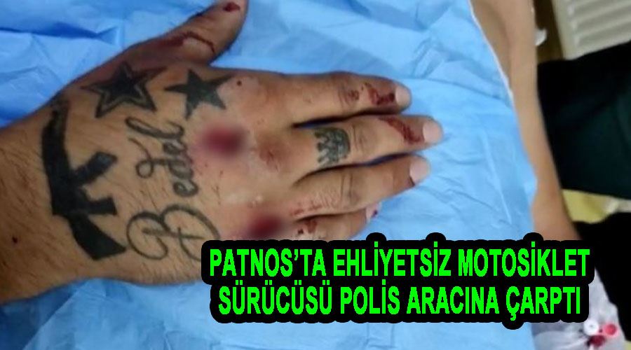 Patnos’ta ehliyetsiz motosiklet sürücüsü polis aracına çarptı