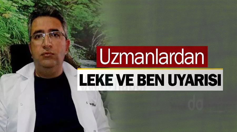 Uzmanlardan leke ve ben uyarısı