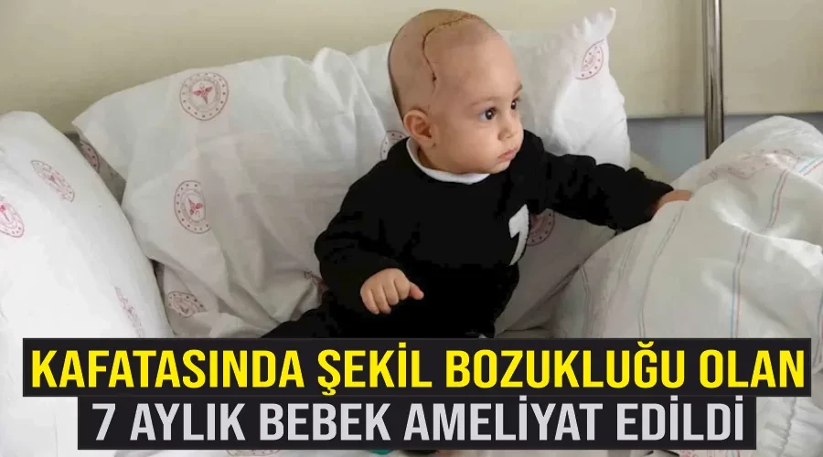 Kafatasında şekil bozukluğu olan 7 aylık bebek ameliyat edildi